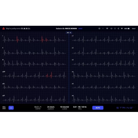 Aparat EKG OPUS 1
